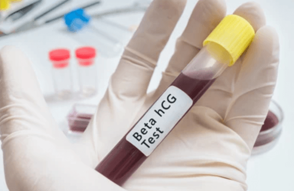 7 Symptoms That May Prompt You to Take a Beta HCG Test