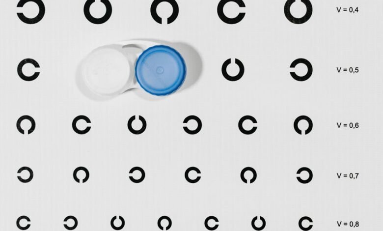 ignite vision engagement lens