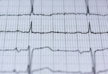 prism pulse conversion strategy
